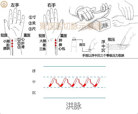 脈象圖